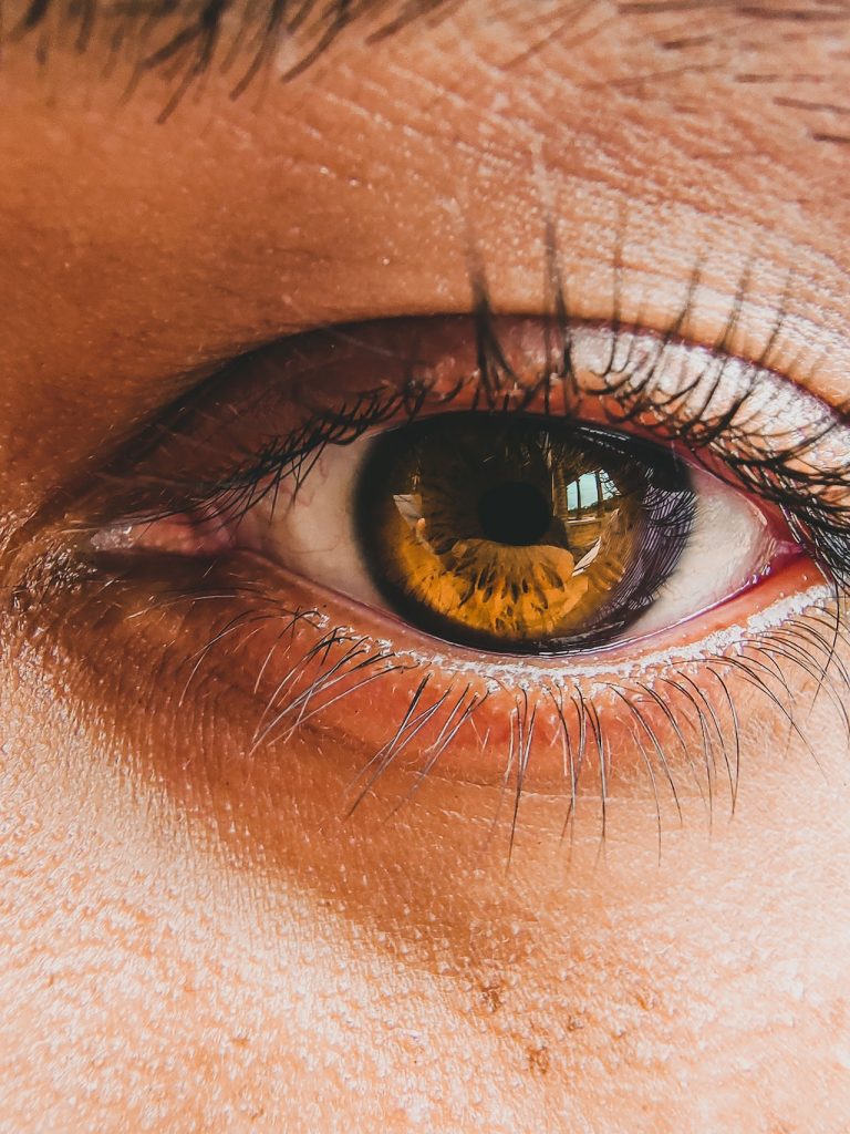 How rare are Sanpaku Eyes