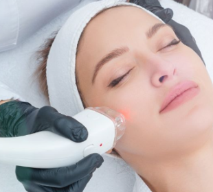 Skin laser treatment