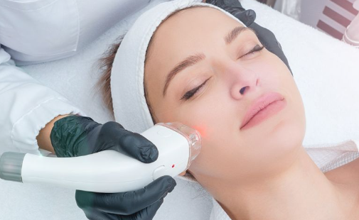 Skin laser treatment